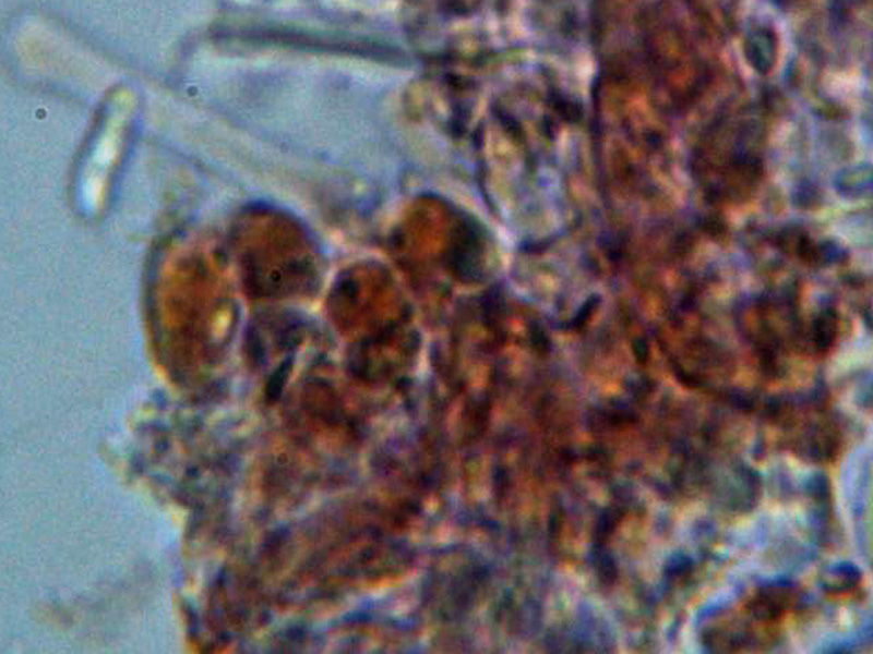 ¿Oligoporus?.........................